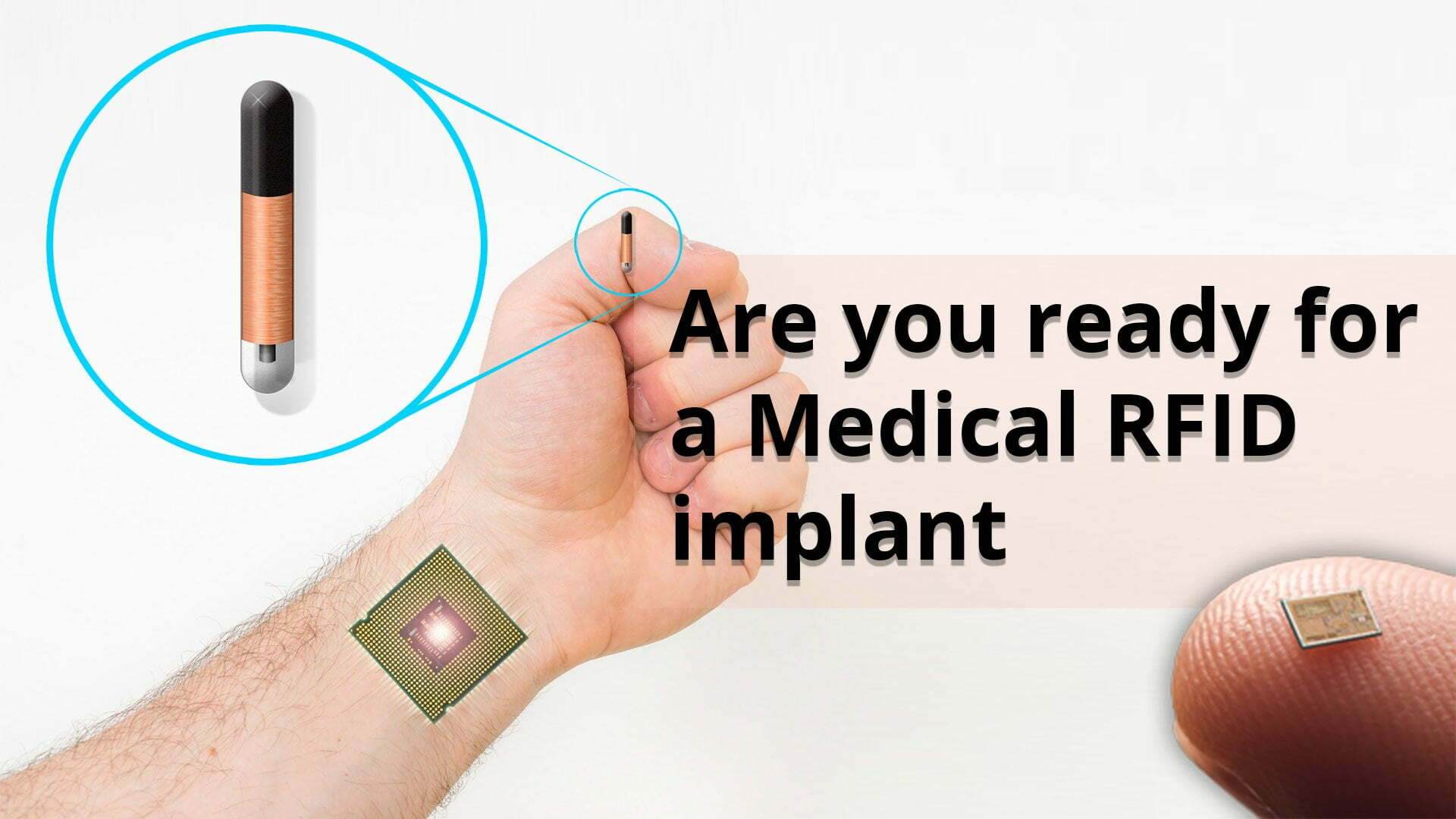 Microchip_Implant Routeget Technologies Limited